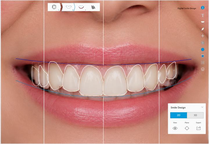 Digital Smile Design